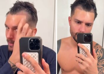 ''Era una cosa che volevo fare'': Andrea Zelletta si fa vedere sui social dopo il trapianto di capelli