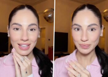 Giulia De Lellis ha fatto le punturine dopo il parto? Tutti glielo chiedono, le sue parole