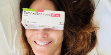 ''Effetti collaterali piuttosto aggressivi'': Carla Bruni dopo 5 anni ha terminato la terapia per il cancro al seno