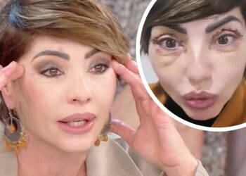 ''Guardate i miei occhi, sono bellissima'': Ilaria Galassi di 'Non è la Rai' si mostra soddisfatta in tv dopo l’intervento estetico