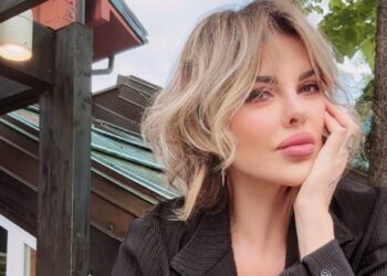 ''Ho imparato a conviverci'': Alba Parietti parla dei suoi ritocchini e svela cosa è andato ‘storto’ col chirurgo estetico