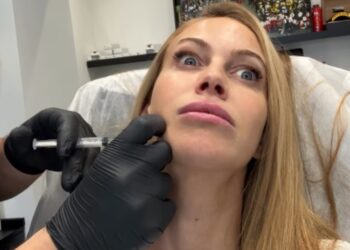 Taylor Mega mostra il suo appuntamento con il botox