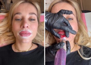 ''Risultato pazzesco!'': Clizia Incorvaia rivela il segreto delle sue labbra perfette