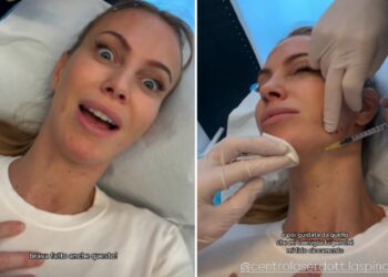''Io ho iniziato a 20 anni'': Taylor Mega si mostra mentre si fa il Botox e ammette di sottoporsi alle punturine da 12 anni