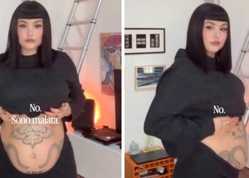 Giorgia Soleri mostra la sua ''pancia da endometriosi'' sul social per rispondere a chi le chiede se è incinta Giorgia Soleri mostra la sua ''pancia da endometriosi'' sul social per rispondere a chi le chiede se è incinta