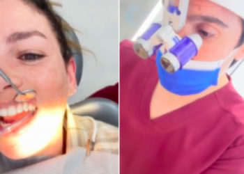 Emma Marrone dal dentista per un motivo estetico: guarda