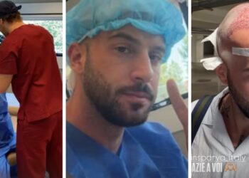 ''Non si torna più indietro!'': Andreas Muller ha deciso di risolvere il suo ‘problemino’ e si è sottoposto a un trapianto di capelli, guarda