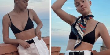 ''Sei una creatura bellissima'': Natalia Paragoni si mostra con i capelli rasati dopo la chemio e commuove tutti